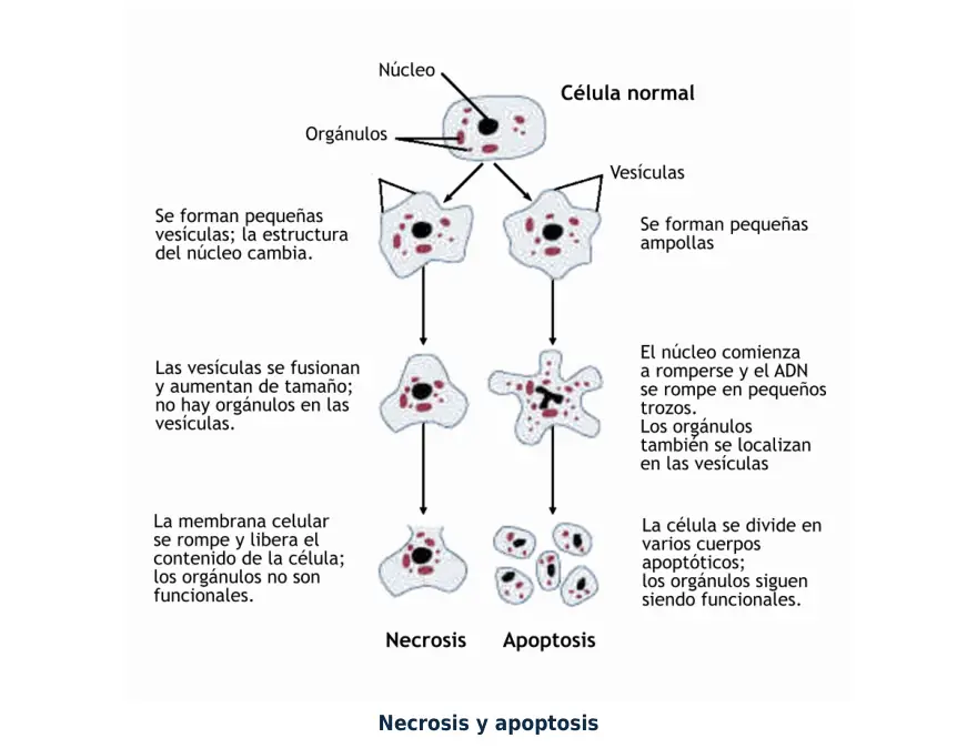 Figura 1.4. Necrosis contra apoptosis: la necrosis rompe la célula y causa inflamación; la apoptosis la fragmenta de forma ordenada.