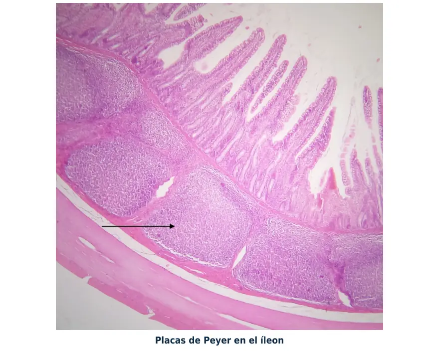 Figura 1.3. Placas de Peyer: folículos linfoides en la submucosa del íleon, parte del tejido linfoide asociado a mucosas, que vigila los antígenos que llegan con los alimentos.