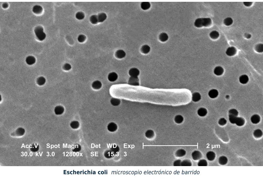 Figura 1.1. Escherichia coli al microscopio electrónico de barrido: bacilos de unas 2 micras, la bacteria que más se aísla en las infecciones urinarias.