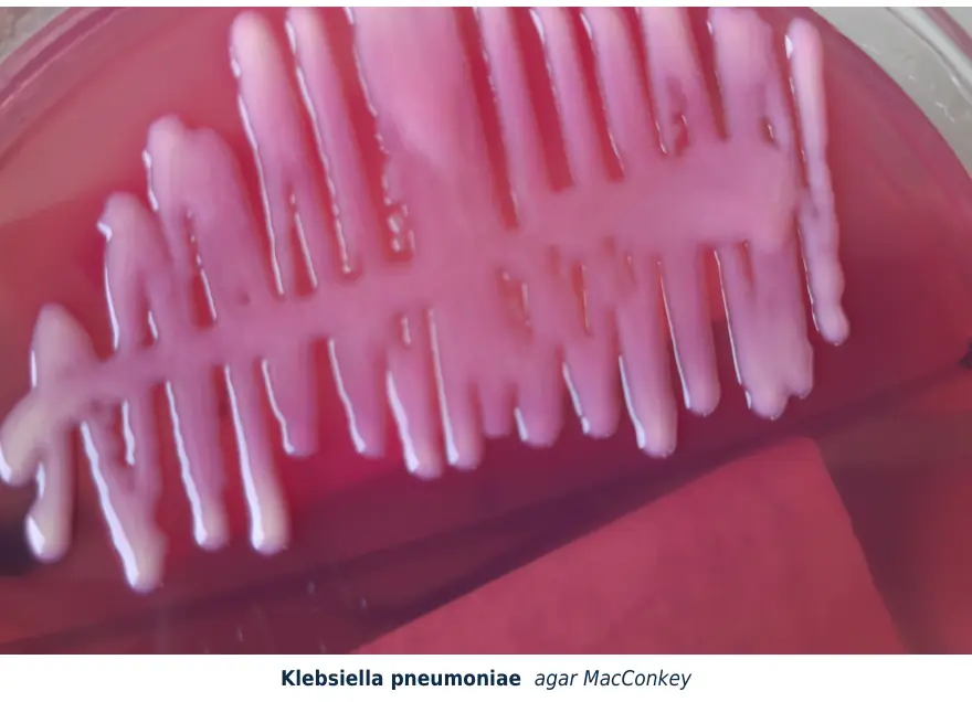 Figura 1.4. Colonias mucoides y rosas de Klebsiella pneumoniae en agar MacConkey: fermenta la lactosa y su cápsula le da el aspecto mucoso.